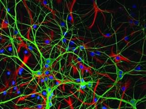 Hippocampal_Neurons_-_Exercise